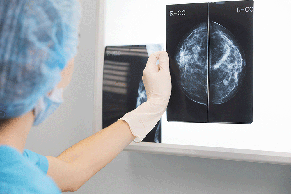 Breast Cancer Surgery Overview